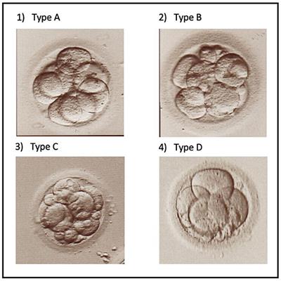 The Effect of GH Administration on Oocyte and Zygote Quality in Young Women With Repeated Implantation Failure After IVF